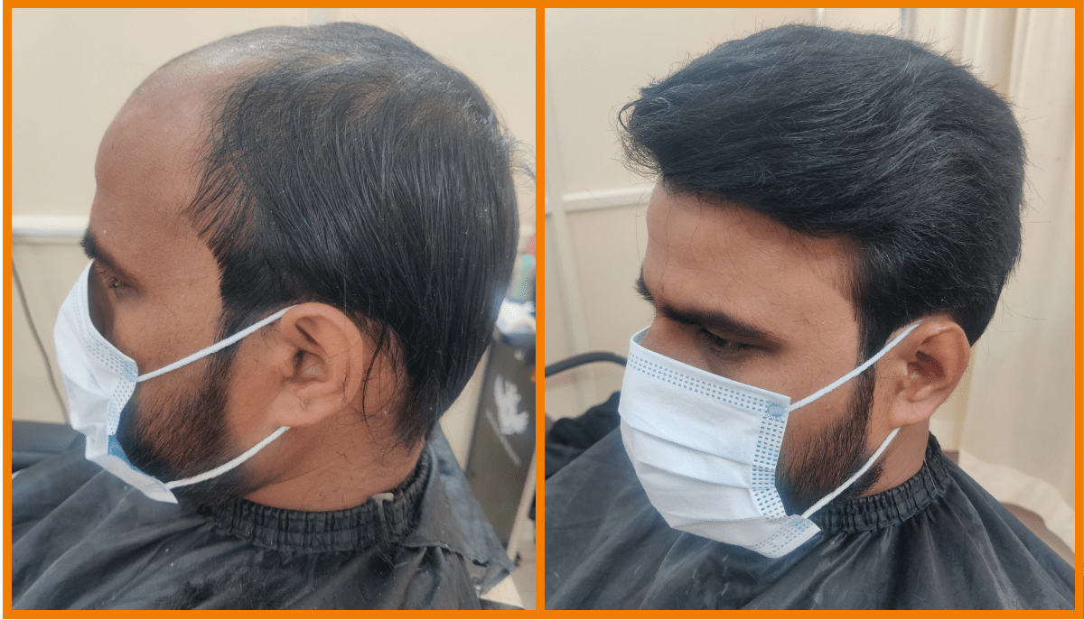 Hair bonding services