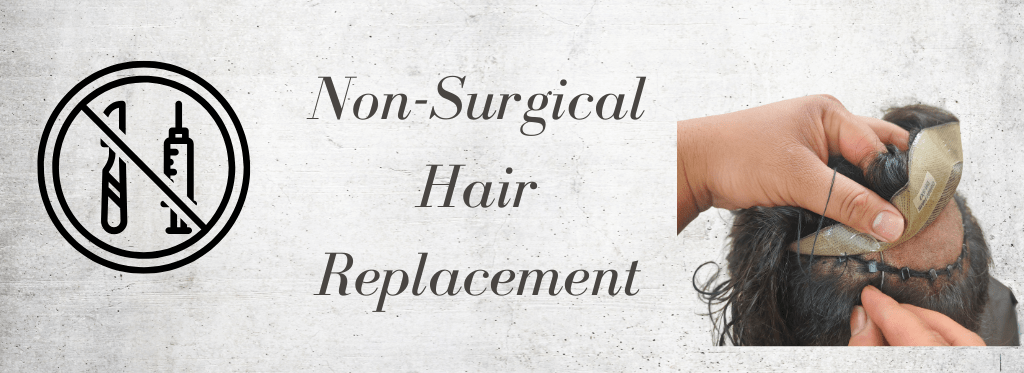 Non-Surgical Hair Replacement