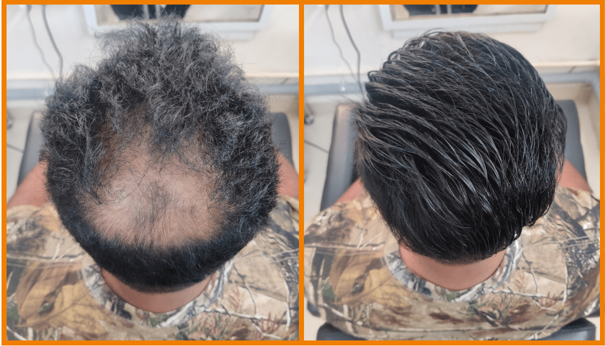 Best hair wigs for men